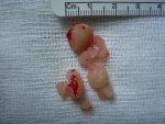 Urethral obstruction This is a life threatening medical emergency.