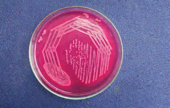 Jan.-June.2015 Fig.1(a)- Strain of Staphylococcus aureus showing resistance to oxacillin & cefoxitin R Fig.