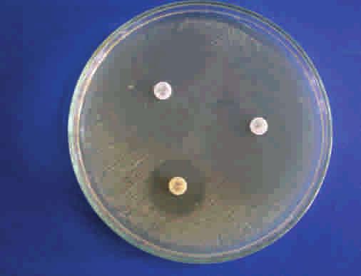 , BioMed Research International.2014:1-5 EJ Fig.2- Lactose fermenting colonies of E.coli on MacConkey agar Fig.3- Golden yellow pigmented colonies Staphylococcus aureus on nutrient agar 4.
