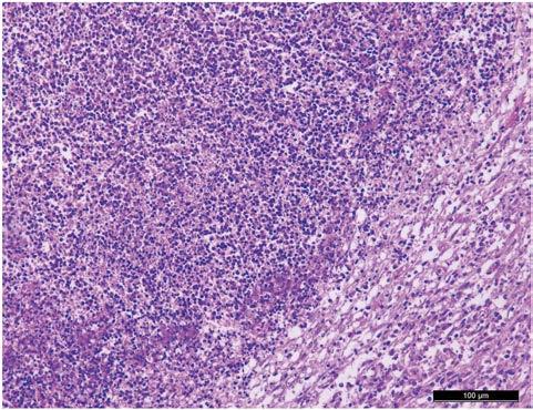 Porcine Liver Abscess Associated with Streptococcus suis Serotype 4 the Kirby-Bauer disk diffusion test on S.