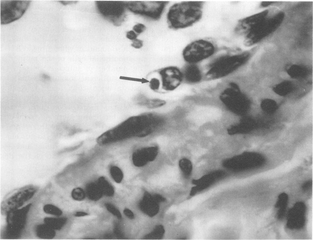 266 HILDEBRANDT ET AL. INFECT. IMMUNITY ethylenediaminetetraacetic acid from a carrier dog. At 14 days postinoculation when early signs of infection were evident, the dog was killed.