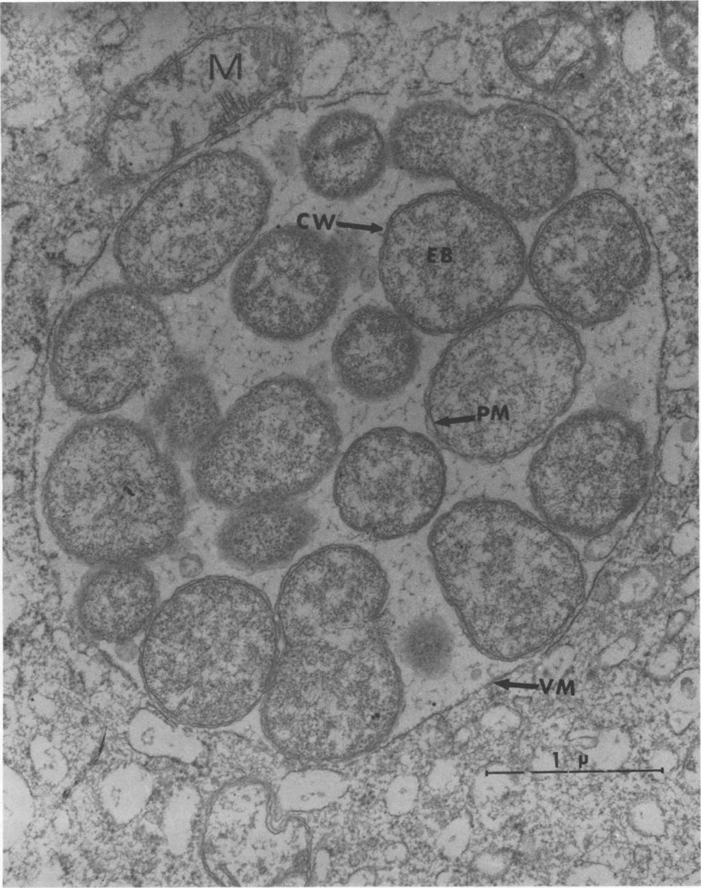 VOL. 7, 1973 ULTRASTRUCTURE OF E. CANIS 269 -v W~~~~~~~~~~~~~~ 4 N~~~~~~~~. FIG. 5. Inclusion of E. canis in a cultured monocyte.