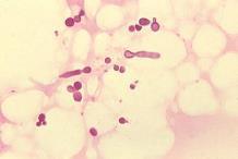 Infections: Dogs and Cats Molds Aspergillus (D > C) Hyalohyphomycoses (D > C) Talaromyces, Paecilomyces Phaeohyphomycoses (uncommon) Exophiala, Cladophialophora, Alternaria
