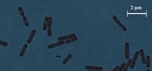 staining Spore formation + data confirm the causative agent of the abscess as Grampositive bacteria. The bacterium was 2 ± 0.5 μm in length and 0.5 ± 0.2 μm width.