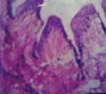 Photomicrograph from the grafted urethral junction using graft on 30 POD (H&E-150),