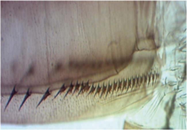 528 A. H. MOHAMED ET AL. Figure 9. Siphon of Form Y Type 2 with 24 pectin spines, of the three distal spines the two more proximal ones have very fine denticles. Figure 10.