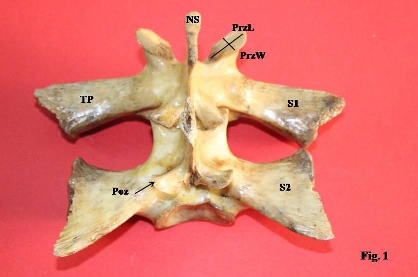 Fig.1 Panoramic view (dorsal) of S 1 to S 2 NS-Neural Spine, TP-Transverse