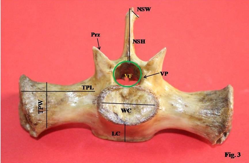 Fig.3 Cranial view of S 1 NSW- Neural Spine Width, NSH- Neural