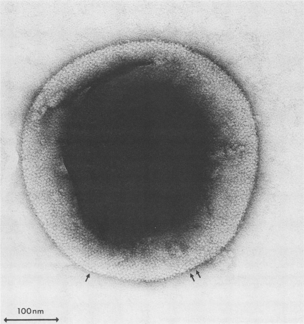 VOL. 58, 1990 CHLAMYDIAL MOMP VACCINE 3103 loqnm 0 -- + / FIG. 2. Electron microgrph of the purified EB vccine preprtion mgnified x 240,000. The rrows indicte obvious prticles on the EB surfce.
