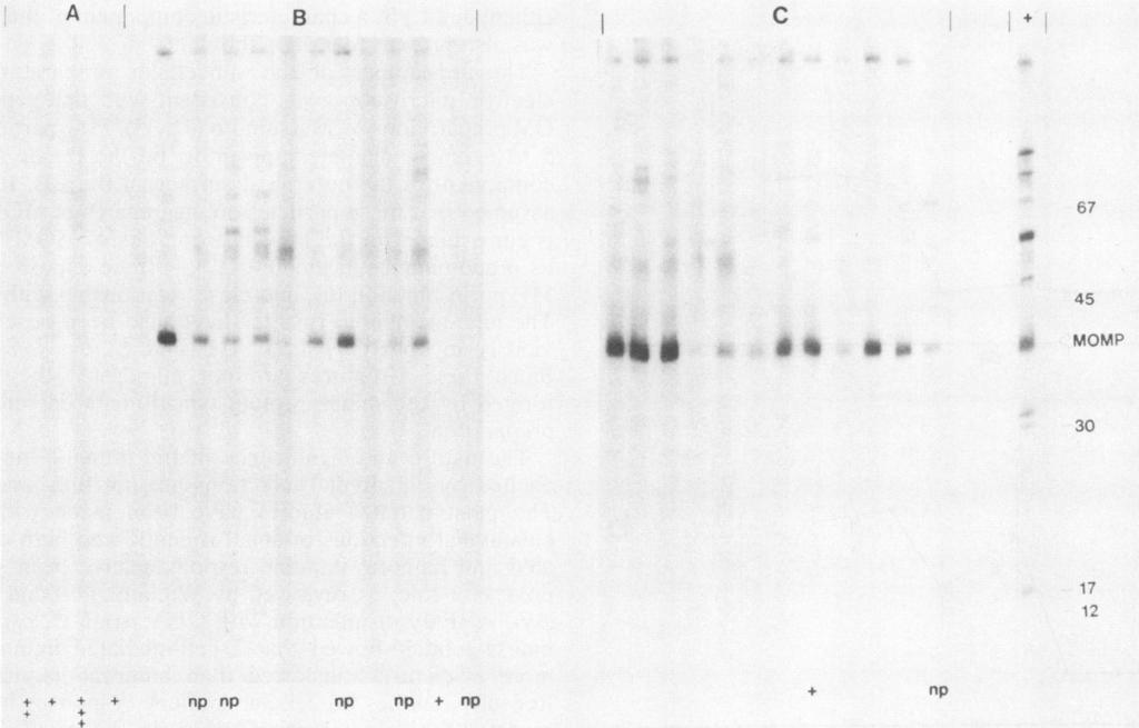 3106 TAN ET AL. INFECT. IMMUN. A B C 45 * 0 IMOMNA 4 + n npfnp np np + np + np FIG. 5. Immunoblots of prechllenge ser from ewes of ll three groups, 4 weeks postvccintion.