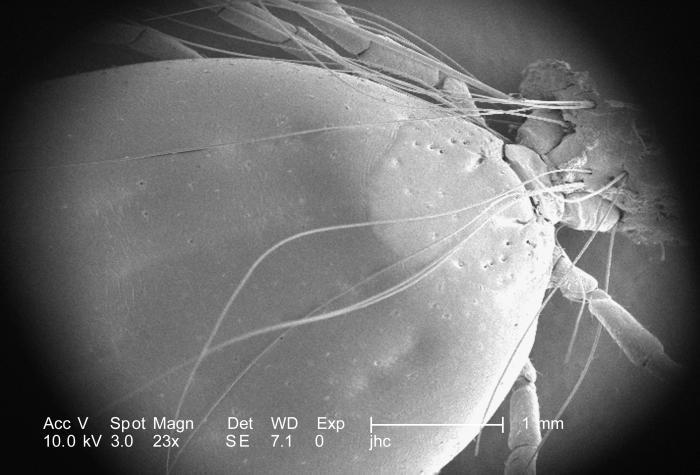 Ixodid tick feeding Palp Hypostome Head Scutum Abdomen (engorged) Image: 2006 Janice Carr PHIL/CDC Low