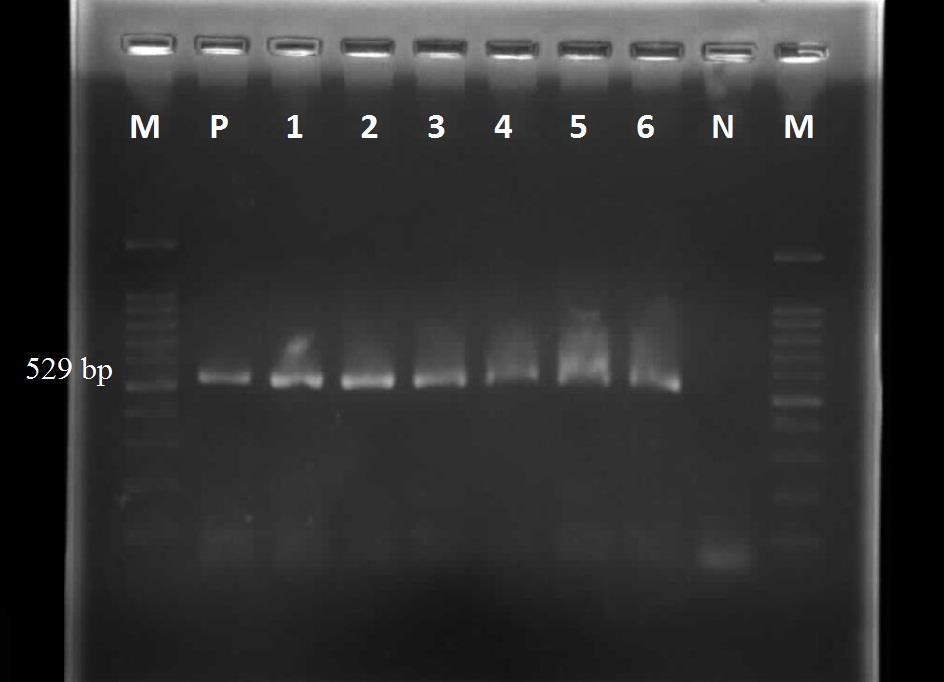 Iran J Parasitol: Vol. 13, No. 1, Jan-Mar 2018, pp.114-119 The primers TOX4 (5'CGCTGCAGGGAGGAA- GACGAAAGTTG3') and TOX5 (5'CGCTGCAGA- CACAGTGCATCTGGATT3') were selected for PCR assay.