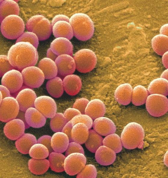 Building Bridges, Supporting Livelihoods Staphylococcus aureus Agent: Gram+, clustered coccal bacteria Ecology: Found on skin of humans and