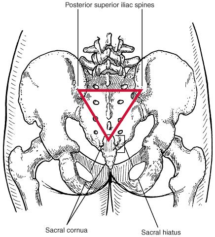 15 ANATOMY OF CAUDAL EPIDURAL SPACE The key to success in any regional technique is a clear understanding of the normal anatomy of the region and an appreciation of the variations that may be
