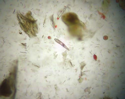 Diagnosis Canine demodicosis is diagnosed through microscopic observation of mites in deep skin scrapings (see Figure 4) and/or trichograms.