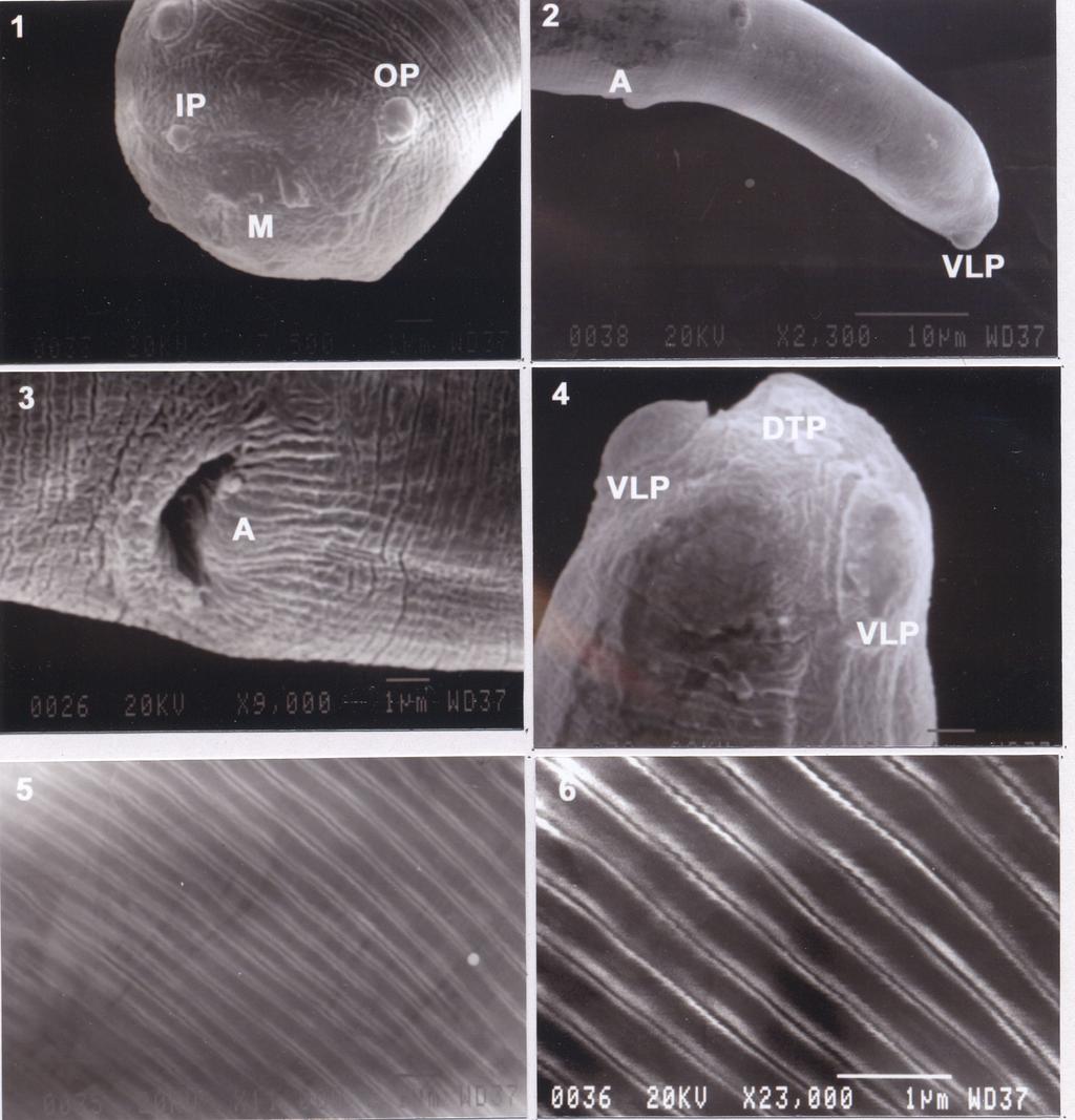 June, 2004 Journal of Vector Ecology 103 Figures 1-6. Scanning electron microscopy of NSP Brugia malayi infective third stage larvae after culturing in NI- FBS medium for 7 d.
