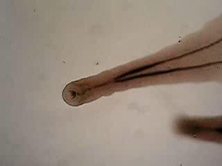 Adult worm of O. felineus in vitro Morphology of O.
