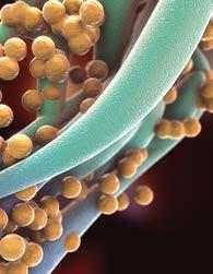 Methicillin-resistant Staphylococcus aureus (MRSA) outbreaks have been reported by the media for more than a decade.