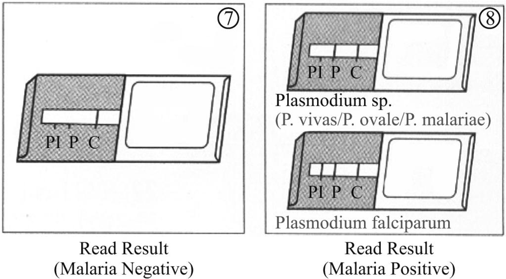 This test has the advantage that it becomes negative when specific treatment is started. Fig. 39.