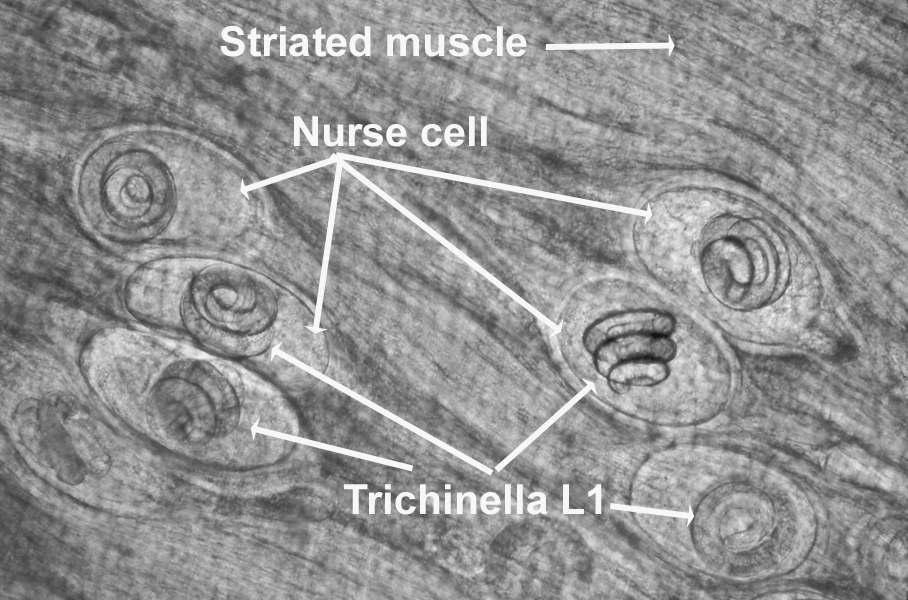 Laboratory 3 Pg. 3 4.) The following slides are on your bench: A. Trichinella spiralis - Cross section of L1 in muscle (#38). See pg. 188, Foreyt.