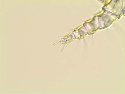 The first pair of legs is located at the cranial end of the mite and the short, stubby legs are highly adapted for grasping hairs.