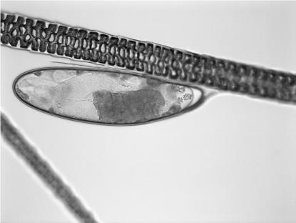 µ. Myocoptes are usually identified by the distinctive morphology of the 3rd and 4th legs.