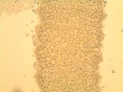 Endoparasites: Metazoa Hymenolepis diminuta: Adult worm measures 20 mm to