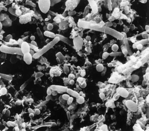 SEM of mixed microbial population recovered from the lavage fluid of patient with