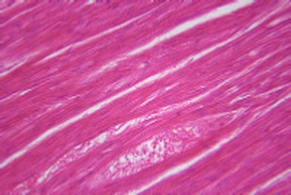 13 - Simple columnar ciliated epithelium of human sec. 14 - Stratified squamous epithelium of human sec. 15 - Epithelium cells of cavitas oris of human w.m. 16 - Hypodermal tissue of cervical of guinea pig 17 - Loose connective tissue w.