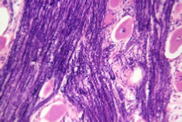 Cat #: CH-COMP3 - COMPARATIVE NERVOUS SYSTEM SLIDE SET - 31 slides 1 - Spinal cord of bull smear 2 - Neurocytes islolated w.m. 3 - Spinal cord of rabbit t.s. (silver staining) 4 - Motor end plate w.m. (gold chloride staining) 5 - Cerebrum of horse sec.