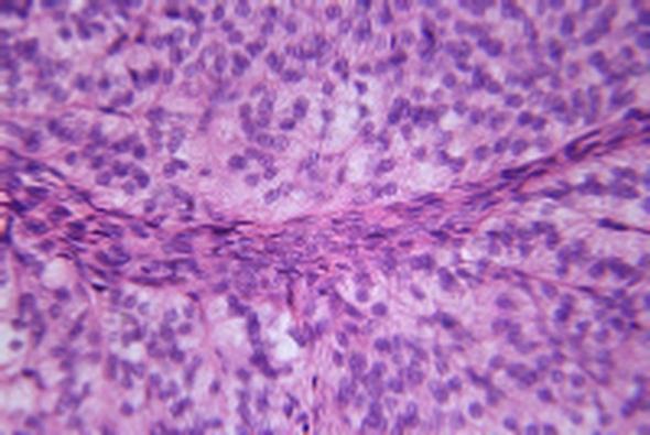 33 - Thyroid gland of rabbit sec. 34 - Human pituitary sec. 35 - Adrenal gland of dog sec. For slide set prices see page 40.