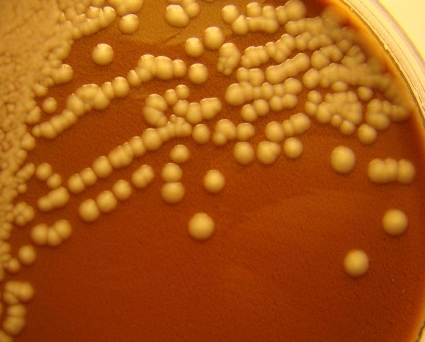 Sample 11/2010 Pus from an ovarial abscess Gowth on a chocolated agar plate in