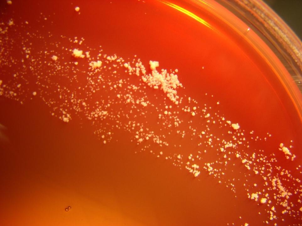 Sample 11/2010 Pus from an ovarial abscess Growth on an anaerobic phenylethylalcohol (PEA) agar plate after