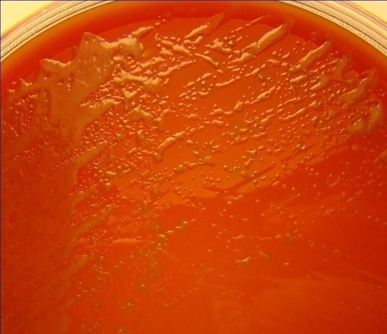 Sample 12/2010: Sputum Growth on a sheep blood and