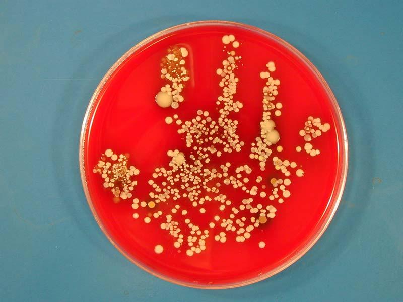 Hand hygiene prevents transmission of healthcare associated infections