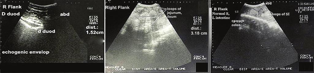 Ultrasonographic findings Ultrasonographic examination of the intestinal tract of the control group was conducted to setup a reference image on comparing with the diseased ones.