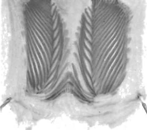 The enlarged teeth at the apices of the chevrons of P. vertebralis are the most distinctive feature observed in the series. R FIG. 17.