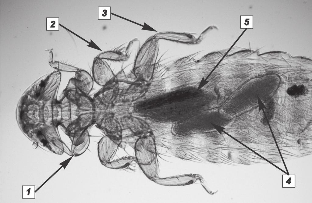 Chewing Lice (Order Mallophaga, Suborders Amblycera and Ischnocera) Fauna of Domestic Chicken 97 5 7 8 } 6 5 { Fig.
