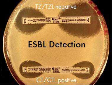 ESBL Confirmatory Tests Disk Diffusion Etest CAZ, Ceftazidime CAZ CLA, Ceftazidime+clavulanic acid CTX,
