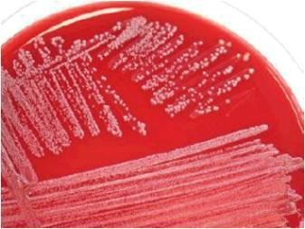 of E coli Sputum gram stain has no PMNs, no organisms