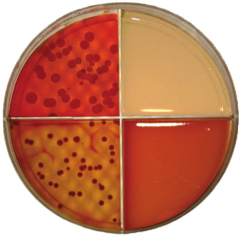 Summary of SSGN Media Reactions Staph Aureus Growth on section 1 and section The colonies on section 4 will show hemolysis or clearing of the red color of the