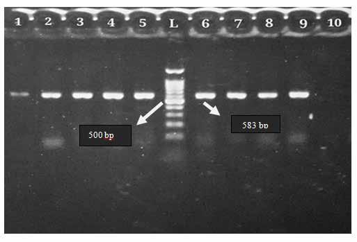 The PCR products were finally sent for DNA sequencing with the above mentioned primers. Fig. 1. MecA gene pattern of agarose gel (1.5%) electrophoresis.