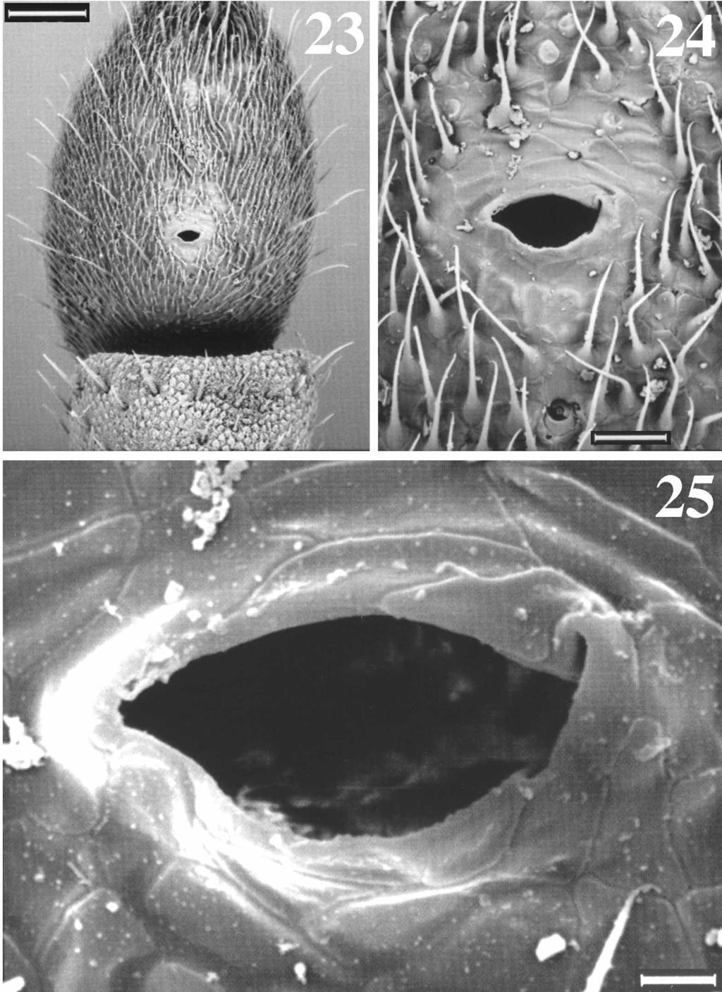 ZOOTAXA FIGURES 23 25.?Martensiellus n. g. sp., female from Kaharian. SEM-micrographs of right tarsus I showing dorsal pore at different enlargements. Scale bars: 100 µm (23), 20 µm (24), 5 µm (25).