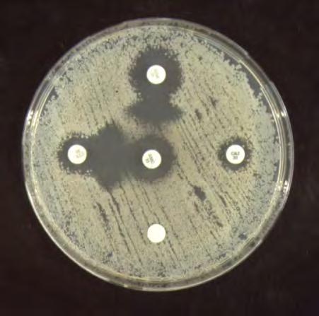 Antimicrobial susceptibility testing Interpretative reading: the classical example ESBL