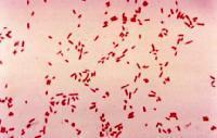 E. coli Culture Red