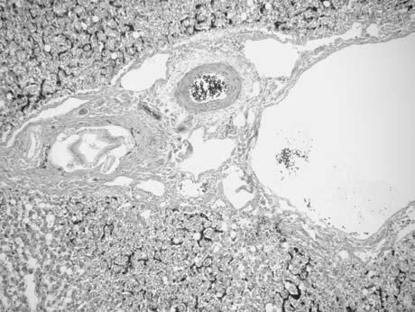 spore eno vezivno tkivo u parenhimu jetre u vidu vezivnotkivnih traka koje okru`uju novoformirane pseudolobuluse. Kako je iz literature poznato (Kne`evi} i sar., 2009; Uetsuka i sar.