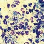 seen, cocci are most likely to be staphylococci or Streptococcus and rods may be Pseudomonas or Proteus (Angus, 2004).