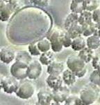 Staphylococcus aureus Legionella pneumophila Mycoplasma