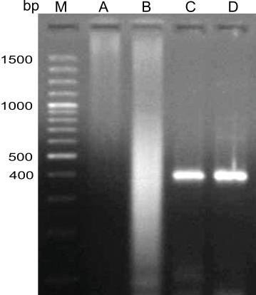Fig. 3. S. lupi specific semi-nested PCR. M - Molecular weight marker (100 bp ladder plus). A, B - products of first round PCR from worm and cyst.