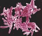 resistant organisms Multidrug resistant TB (MDR TB)